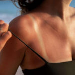Правила ухода за кожей после солнечных ванн — вы забываете об этом